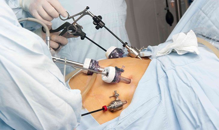 Bariatric Surgery in Kharghar